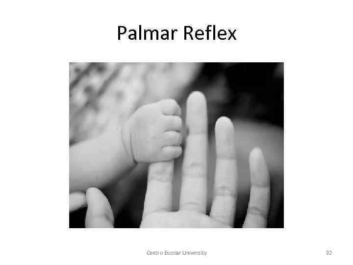 Palmar Reflex Centro Escolar University 32 