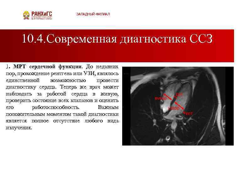 ЗАПАДНЫЙ ФИЛИАЛ 10. 4. Современная диагностика ССЗ 1. . МРТ сердечной функции. До недавних