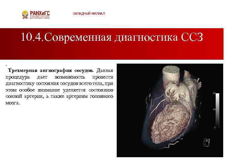 ЗАПАДНЫЙ ФИЛИАЛ 10. 4. Современная диагностика ССЗ. Трехмерная ангиография сосудов. Данная процедура дает возможность