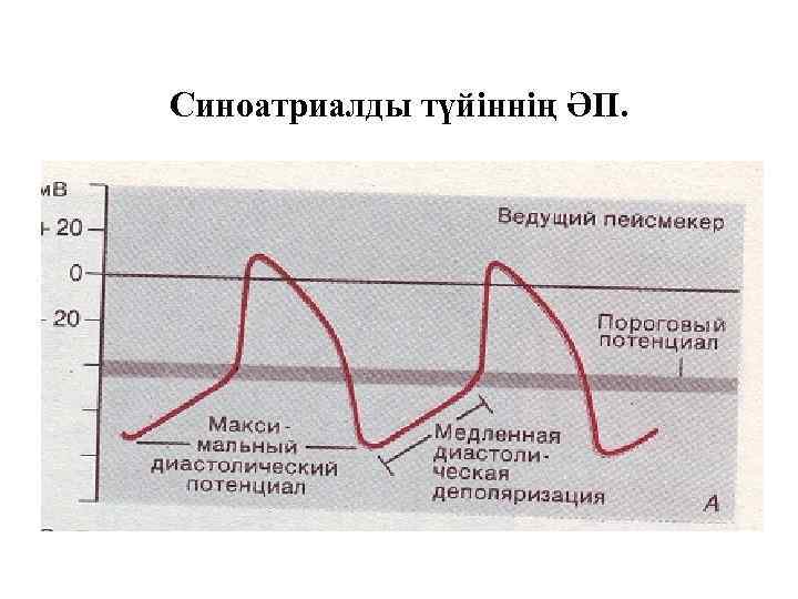 Синоатриалды түйіннің ӘП. 