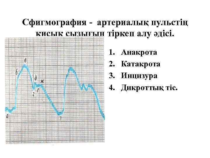 Сфигмография - артериалық пульстің қисық сызығын тіркеп алу әдісі. 1. 2. 3. 4. Анакрота