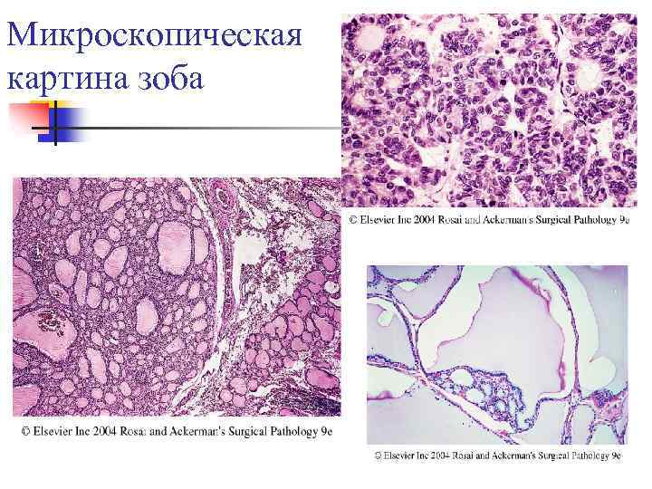 Микроскопическая картина u