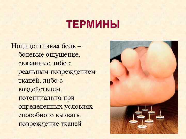 ТЕРМИНЫ Ноцицептивная боль – болевые ощущение, связанные либо с реальным повреждением тканей, либо с