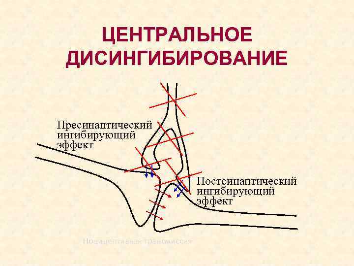 ЦЕНТРАЛЬНОЕ ДИСИНГИБИРОВАНИЕ Пресинаптический ингибирующий эффект Постсинаптический ингибирующий эффект Ноцицептивная трансмиссия 