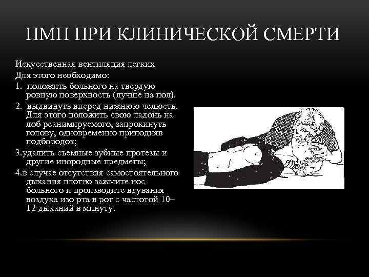 ПМП ПРИ КЛИНИЧЕСКОЙ СМЕРТИ Искусственная вентиляция легких Для этого необходимо: 1. положить больного на