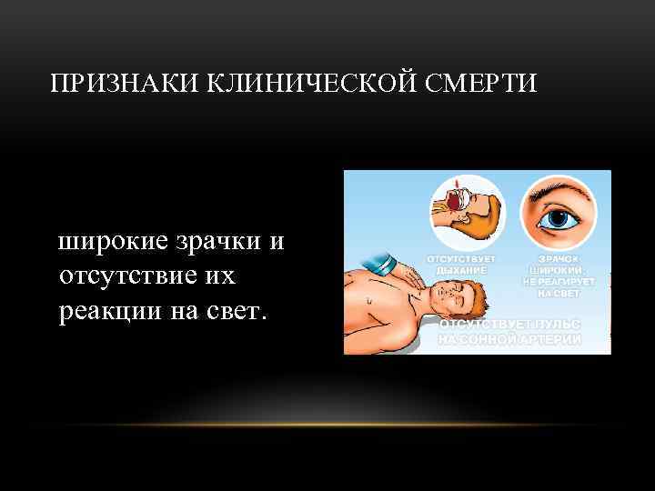 ПРИЗНАКИ КЛИНИЧЕСКОЙ СМЕРТИ широкие зрачки и отсутствие их реакции на свет. 