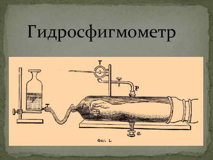 Гидросфигмометр 