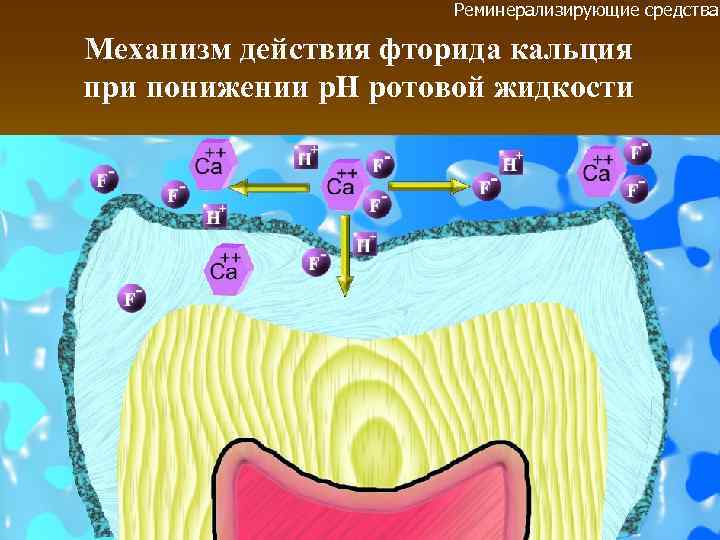 Реминерализирующие средства Механизм действия фторида кальция при понижении р. Н ротовой жидкости 