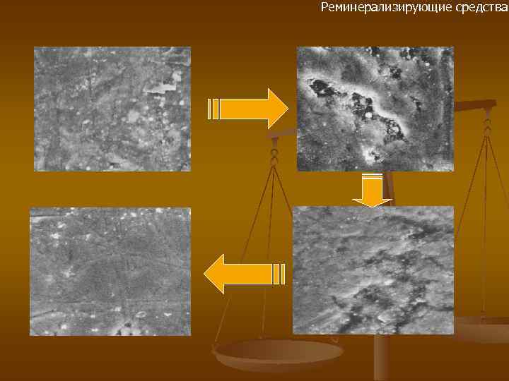 Реминерализирующие средства 