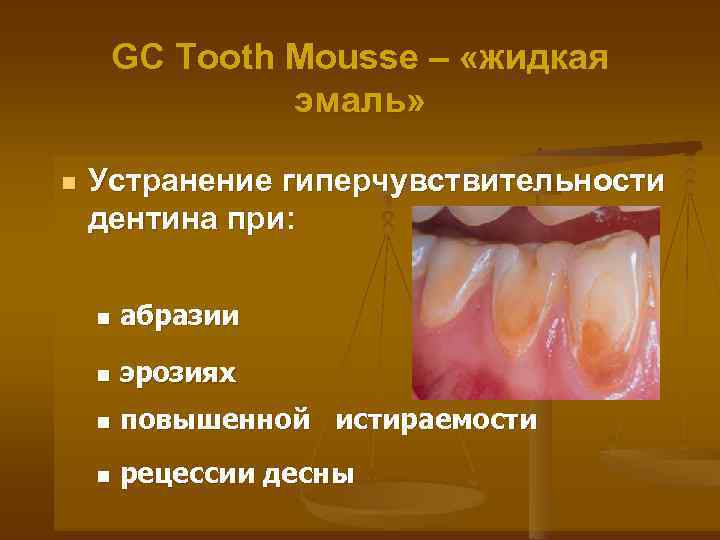 GC Tooth Mousse – «жидкая эмаль» n Устранение гиперчувствительности дентина при: n абразии n