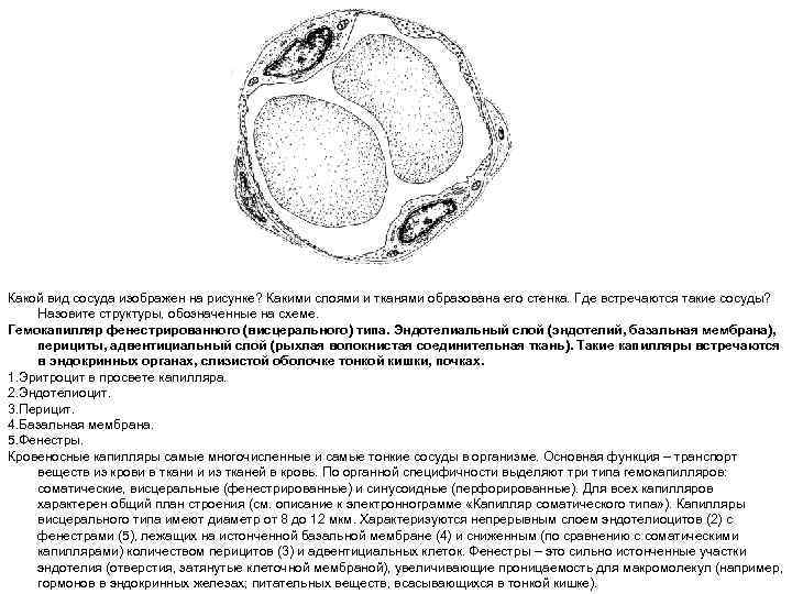 Определите сосуды изображенные на рисунке