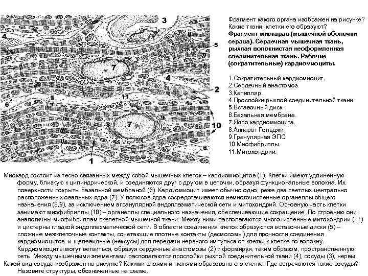 Фрагмент какого органа изображен на рисунке? Какие ткани, клетки его образуют? Фрагмент миокарда (мышечной