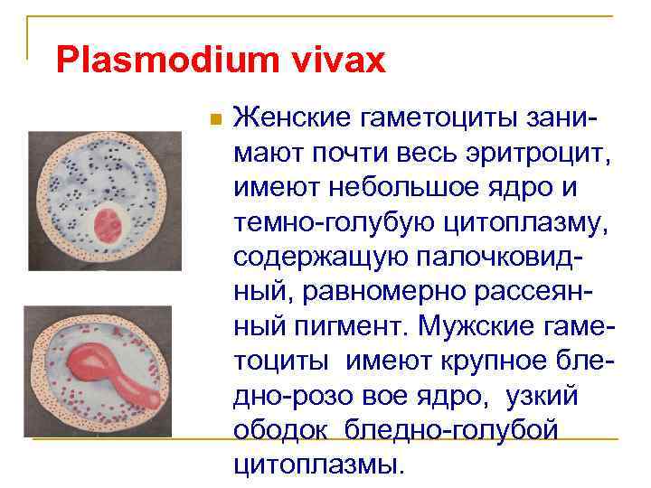 Plasmodium vivax n Женские гаметоциты занимают почти весь эритроцит, имеют небольшое ядро и темно-голубую