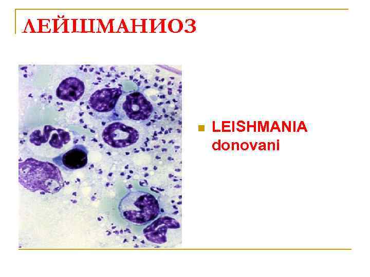 ЛЕЙШМАНИОЗ n LEISHMANIA donovani 