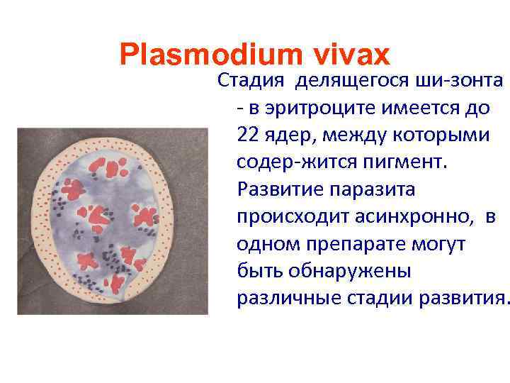 Plasmodium vivax Cтадия делящегося ши-зонта - в эритроците имеется до 22 ядер, между которыми