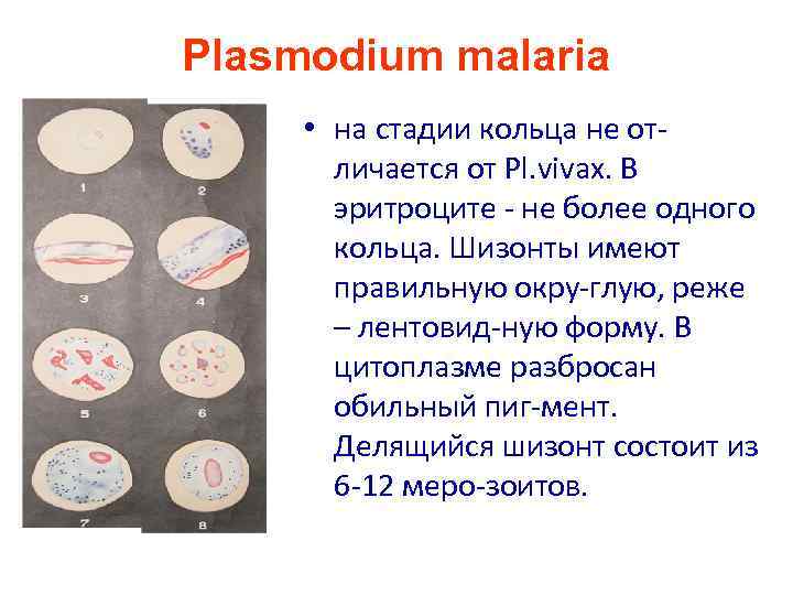 Плазмодиум вивакс. Plasmodium Vivax на стадии кольца. Плазмодий Vivax. Плазмодиум малярия.