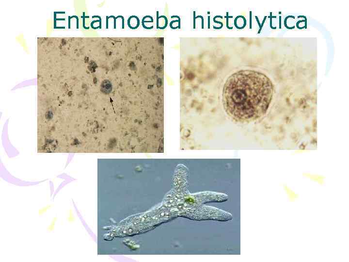 Entamoeba histolytica 