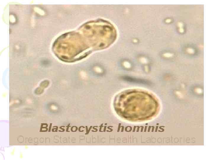 Blastocystis hominis 