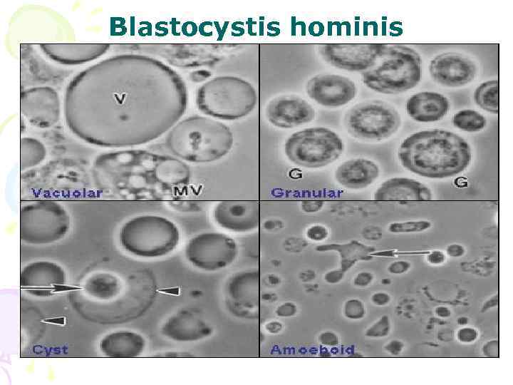 Blastocystis hominis 