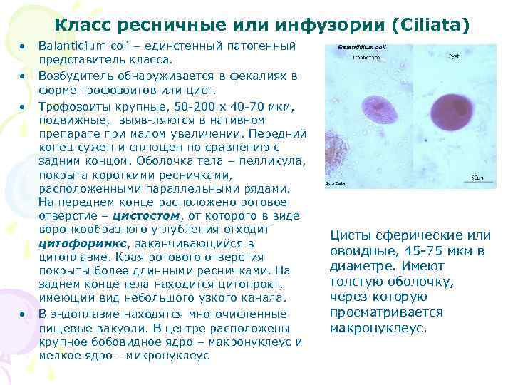 Класс ресничные или инфузории (Ciliata) • • Balantidium coli – единстенный патогенный представитель класса.