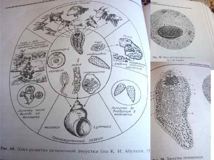 Fasciola hepatica 