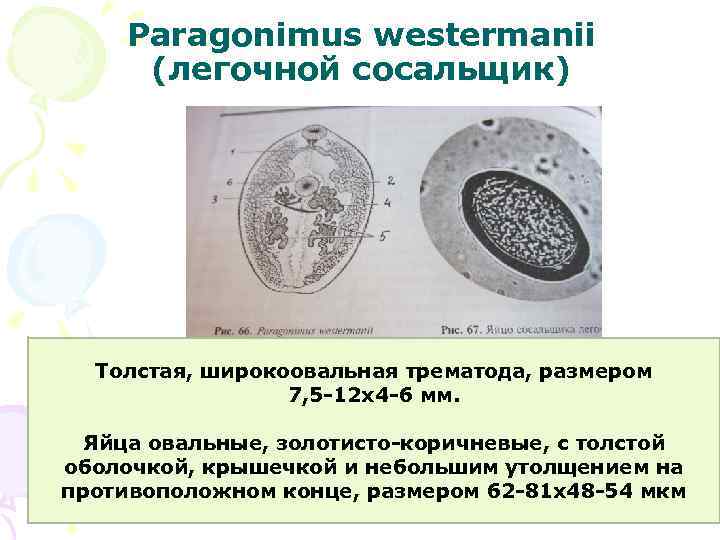 Paragonimus westermanii (легочной сосальщик) Толстая, широкоовальная трематода, размером 7, 5 -12 х4 -6 мм.