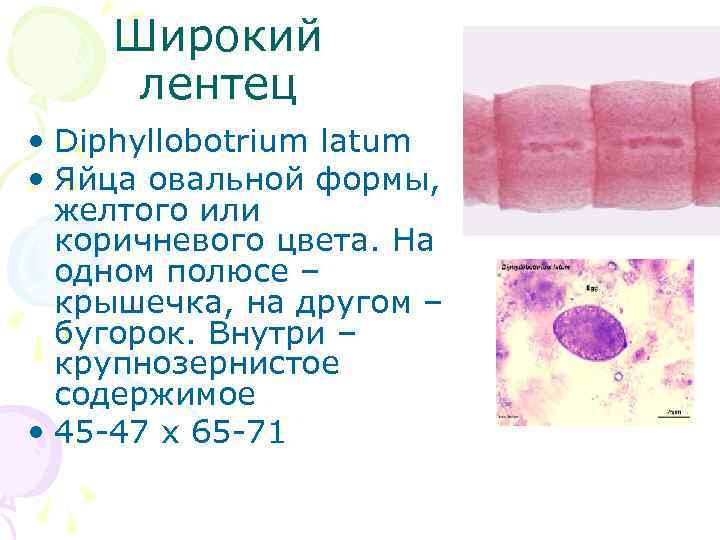 Широкий лентец • Diphyllobotrium latum • Яйца овальной формы, желтого или коричневого цвета. На