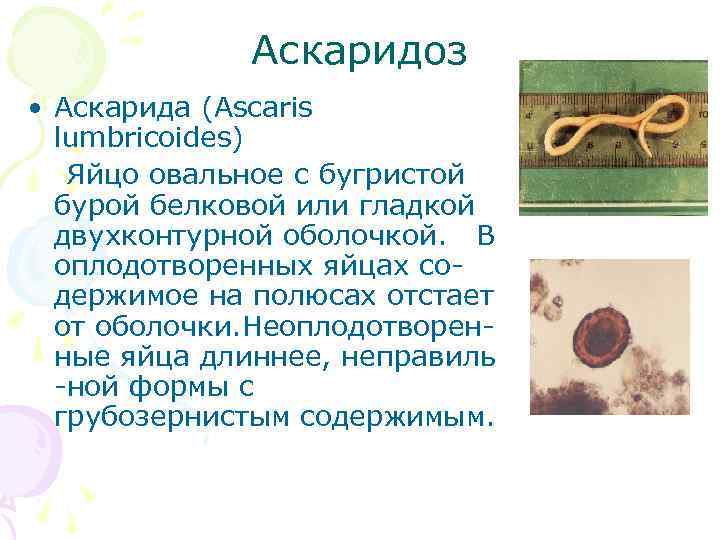 Аскаридоз • Аскарида (Ascaris lumbricoides) Яйцо овальное с бугристой бурой белковой или гладкой двухконтурной