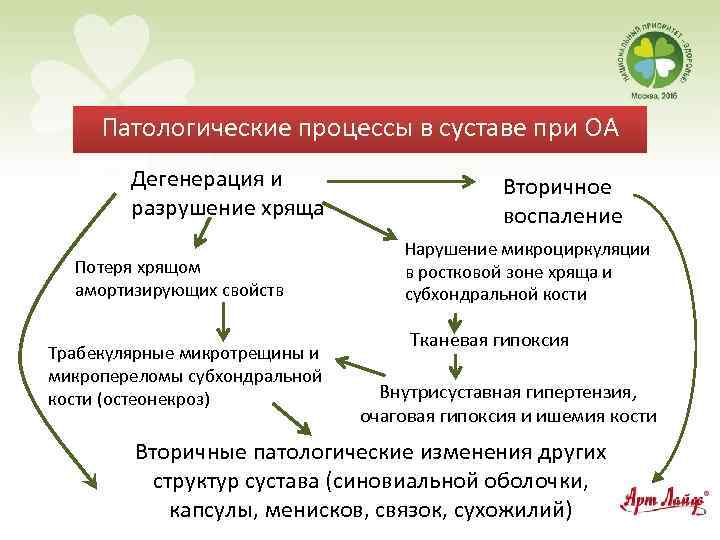 Патологические процессы в суставе при ОА Дегенерация и разрушение хряща Потеря хрящом амортизирующих свойств