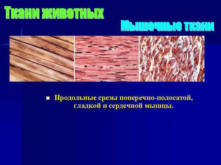 n Продольные срезы поперечно-полосатой, гладкой и сердечной мышцы. 