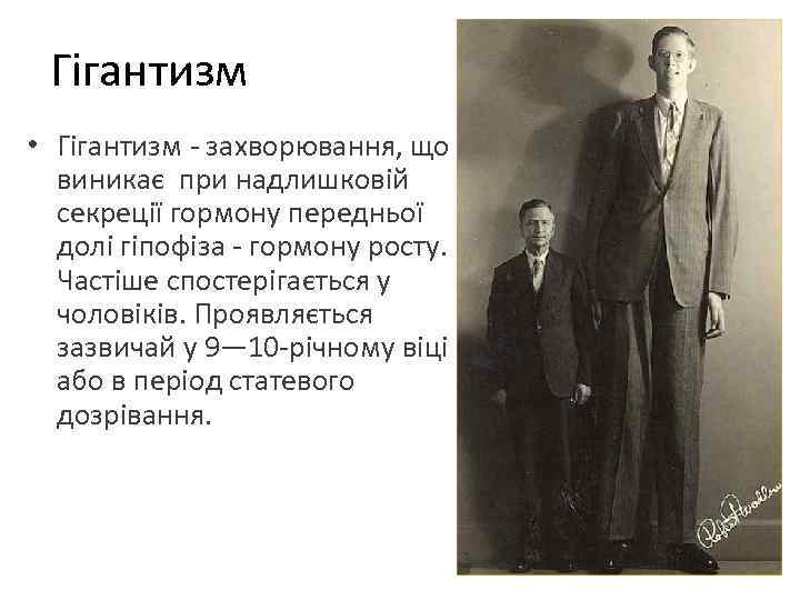  Гігантизм • Гігантизм - захворювання, що виникає при надлишковій секреції гормону передньої долі