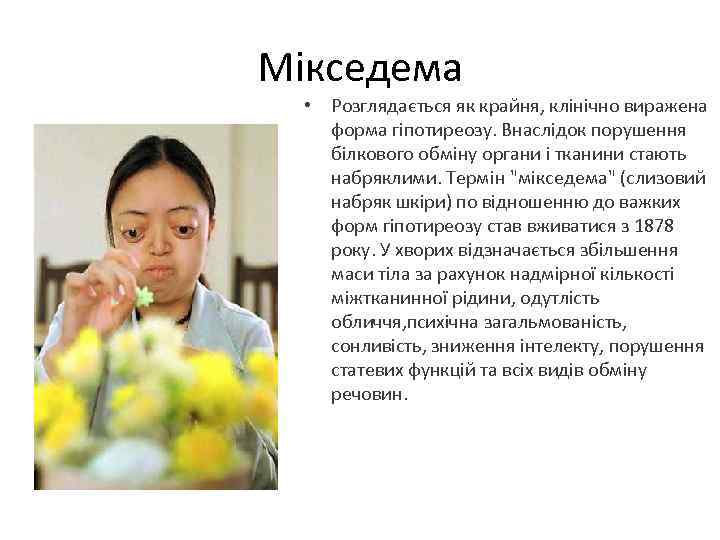 Мікседема • Розглядається як крайня, клінічно виражена форма гіпотиреозу. Внаслідок порушення білкового обміну органи