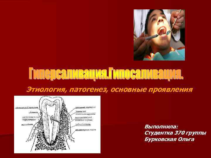 Этиология, патогенез, основные проявления Выполнила: Студентка 370 группы Бурковская Ольга 