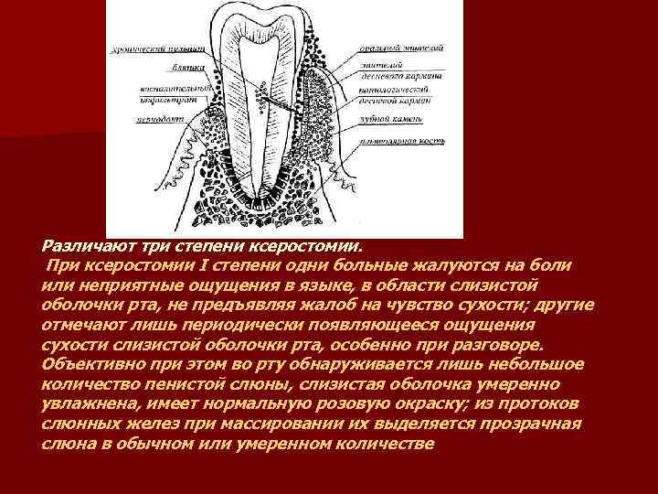 Различают три степени ксеростомии. При ксеростомии I степени одни больные жалуются на боли или