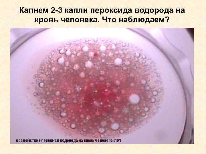 Капнем 2 -3 капли пероксида водорода на кровь человека. Что наблюдаем? 