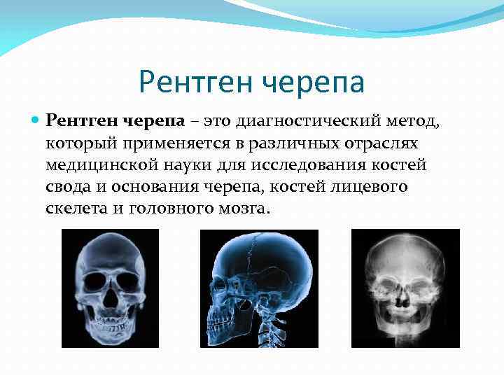 Рентген черепа – это диагностический метод, который применяется в различных отраслях медицинской науки для