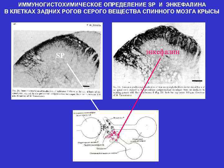 ИММУНОГИСТОХИМИЧЕСКОЕ ОПРЕДЕЛЕНИЕ SP И ЭНКЕФАЛИНА В КЛЕТКАХ ЗАДНИХ РОГОВ СЕРОГО ВЕЩЕСТВА СПИННОГО МОЗГА КРЫСЫ