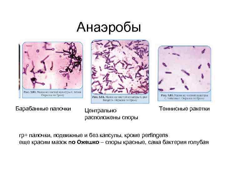 Анаэробы Барабанные палочки Центрально расположены споры Теннисные ракетки гр+ палочки, подвижные и без капсулы,