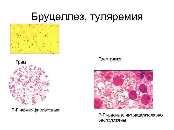 Бруцеллез, туляремия Грам также Р-Г нежно-фиолетовые Р-Г красные, интрацеллюлярно расположены 