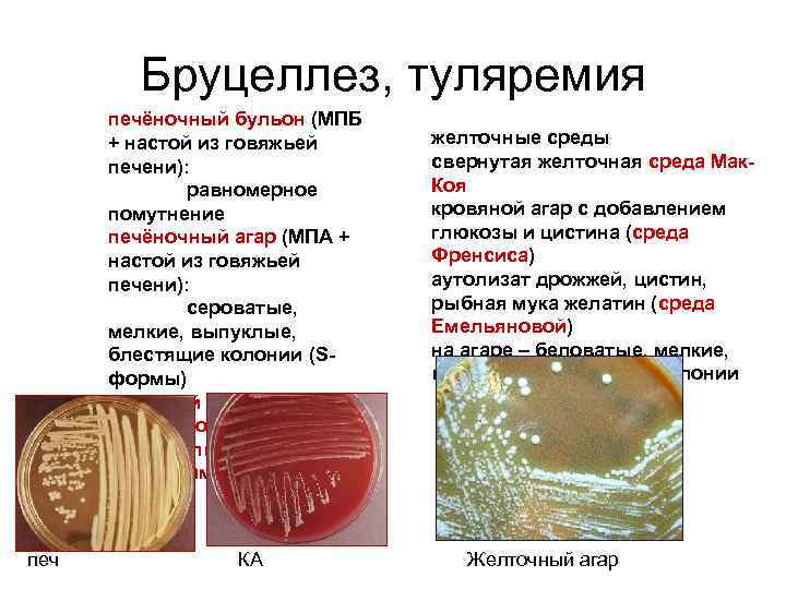 Бруцеллез, туляремия печёночный бульон (МПБ + настой из говяжьей печени): равномерное помутнение печёночный агар