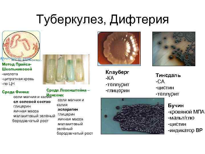 Туберкулез, Дифтерия Метод Прайса. Школьниковой -кислота -цитратная кровь -по ЦН Среда Левенштейна – Среда