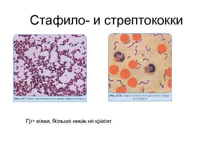 Стафило- и стрептококки Гр+ кокки, больше никак не красят 