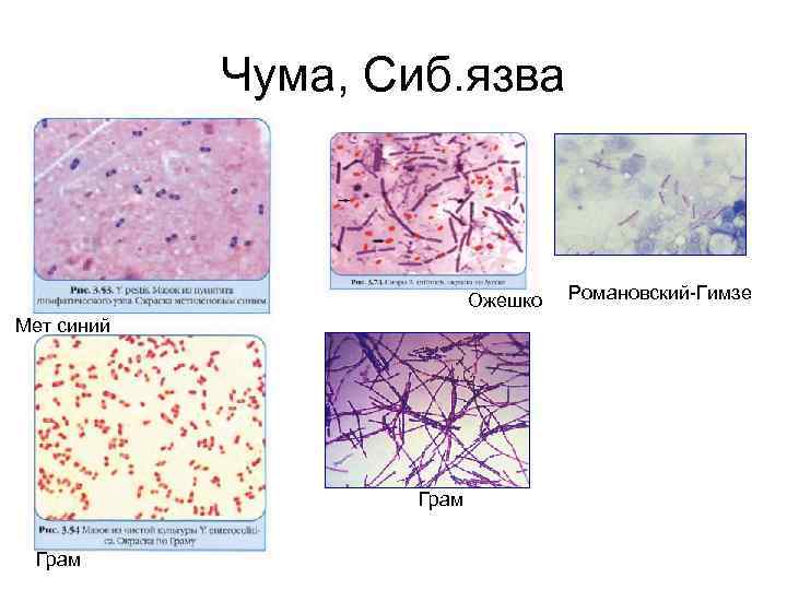 Чума, Сиб. язва Ожешко Мет синий Грам Романовский-Гимзе 