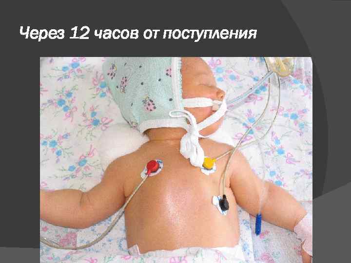 Через 12 часов от поступления 