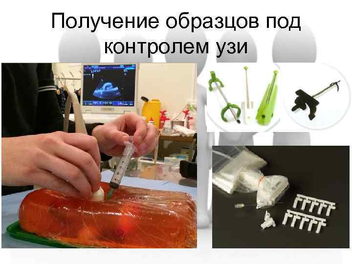 Получение образцов под контролем узи 