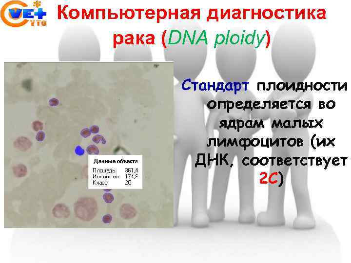 Компьютерная диагностика рака (DNA ploidy) Стандарт плоидности определяется во ядрам малых лимфоцитов (их ДНК,