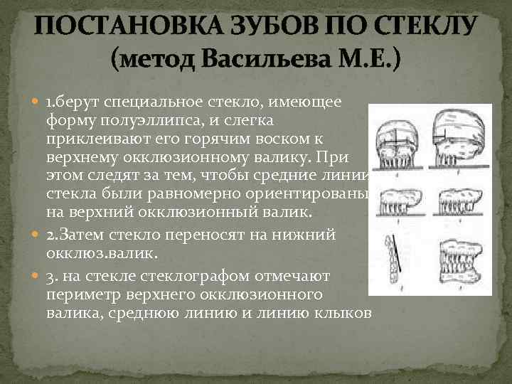 Постановка зубов по индивидуальным окклюзионным кривым презентация