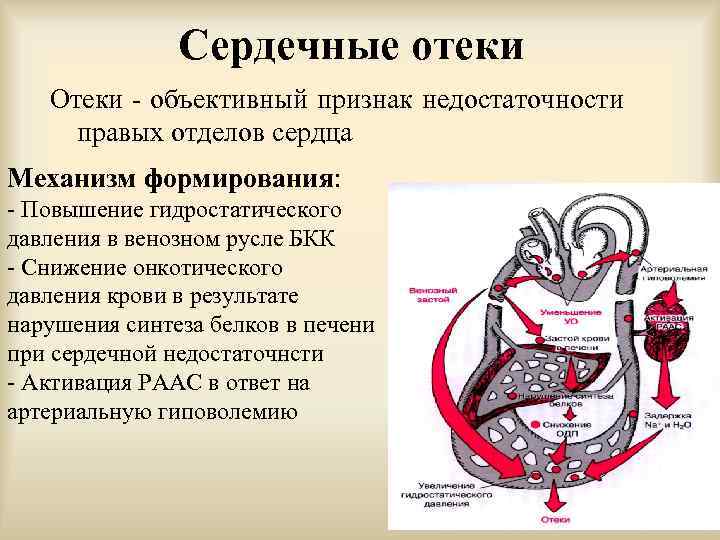 Чем отличаются сердечные отеки от почечных фото