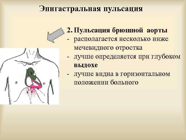 Сильно пульсирует живот. Пульсация брюшной аорты. Эпигастральная пульсация. Пульсирующая брюшная аорта.