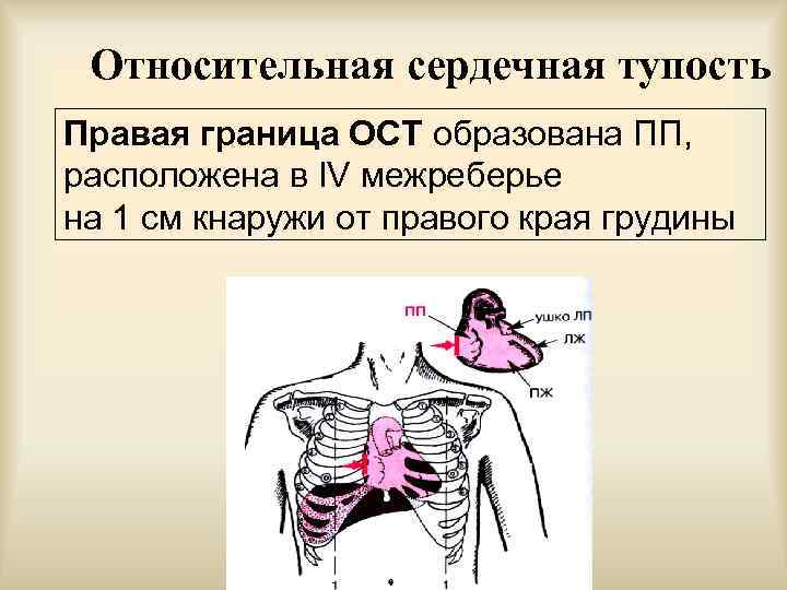 Границы относительной тупости сердца